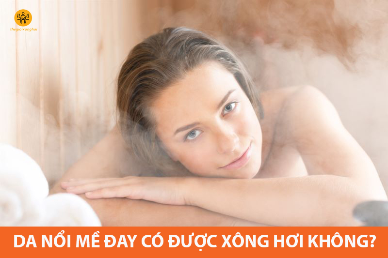 nổi mề đay có nên xông hơi không